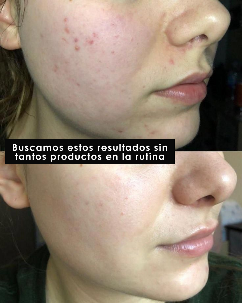 KIT COMPLETO EFECTO PORCELANA – PIEL LUMINOSA EN 2 SEMANAS