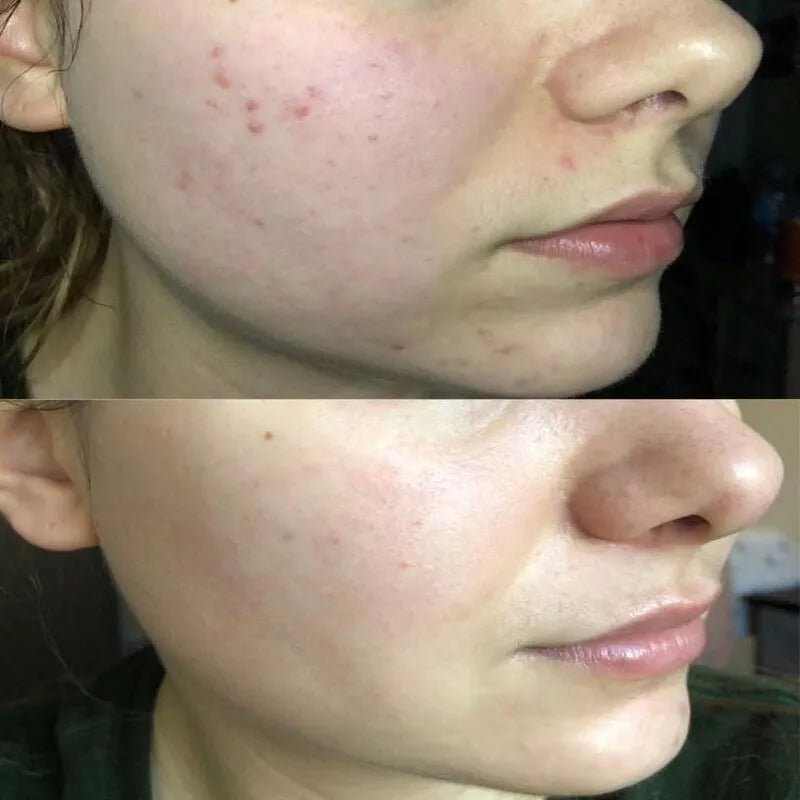 Sérum Efecto Porcelana Día BENDITA TÚ ERES