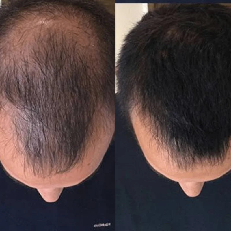 Shampoo Crecimiento DR. ASIAN