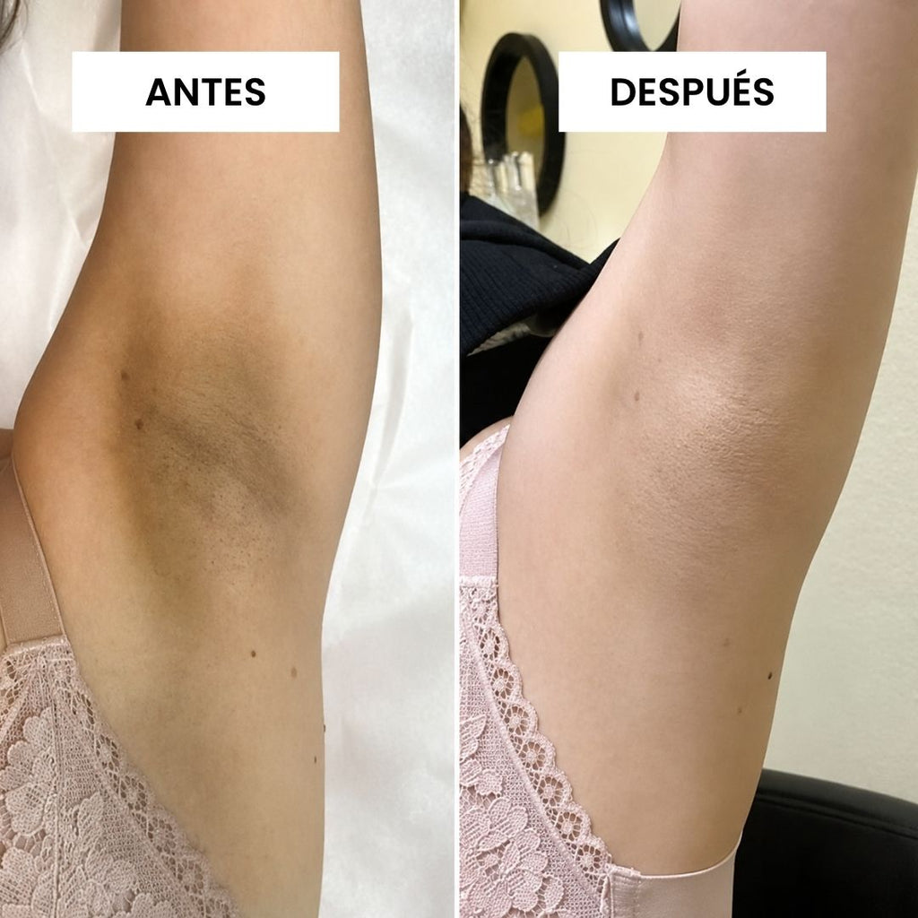 KIT FUNDADOR · CORRECT — Manchas, foliculitis y vellos encarnados