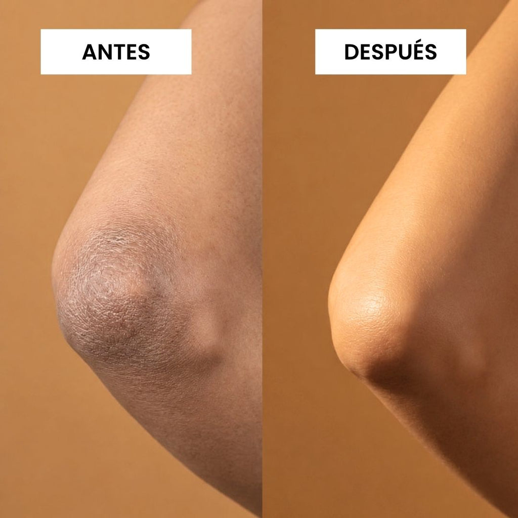 KIT FUNDADOR · CORRECT — Manchas, foliculitis y vellos encarnados