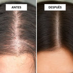 KIT FUNDADOR · CRECE — Caída del cabello