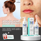 KIT· CARA LIMPIA — Acné y puntos negros