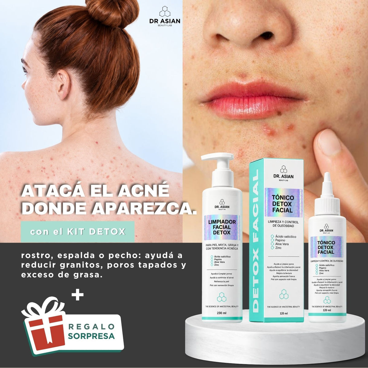 KIT· CARA LIMPIA — Acné y puntos negros