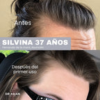 KIT · ANTICASPA — Caspa