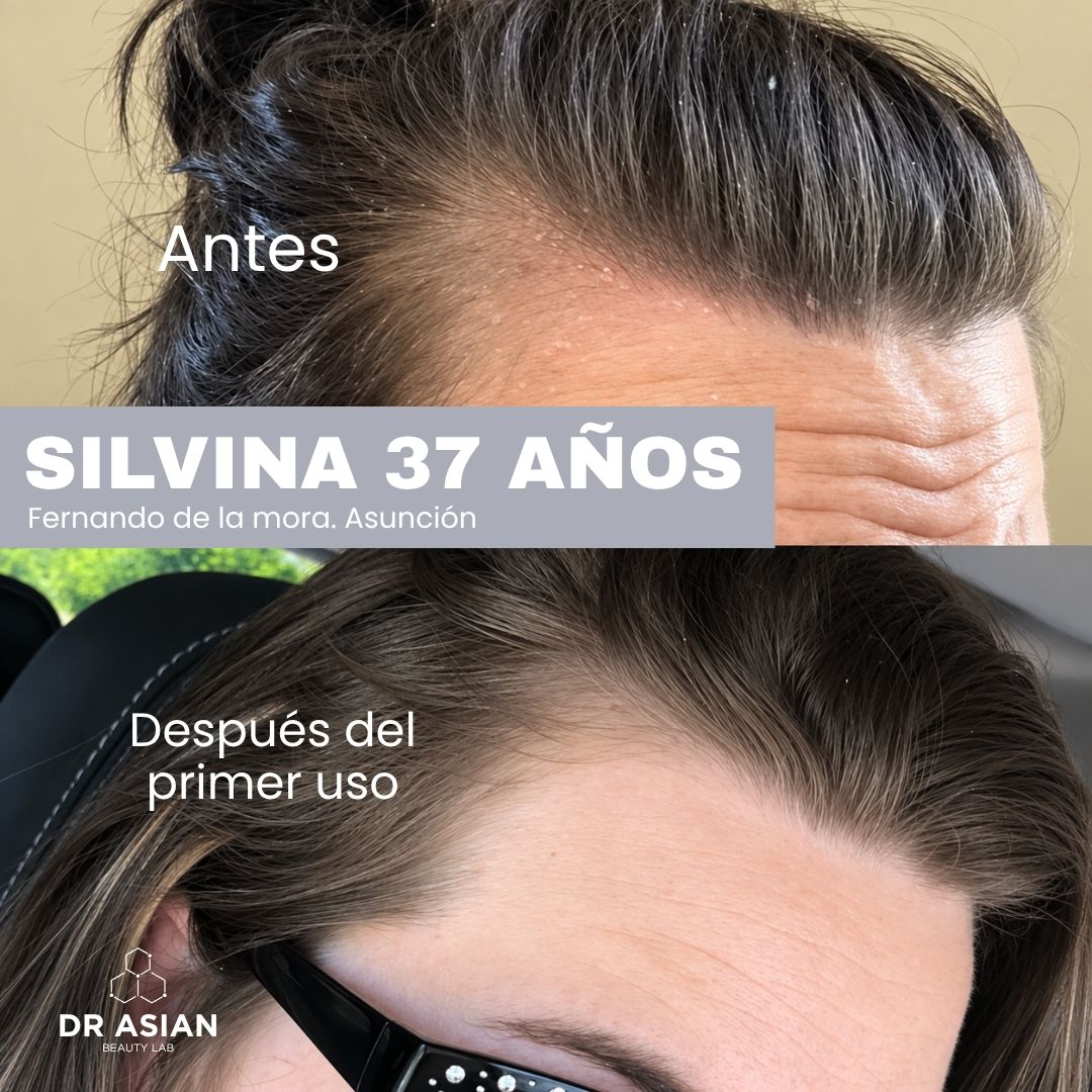 KIT · ANTICASPA — Caspa
