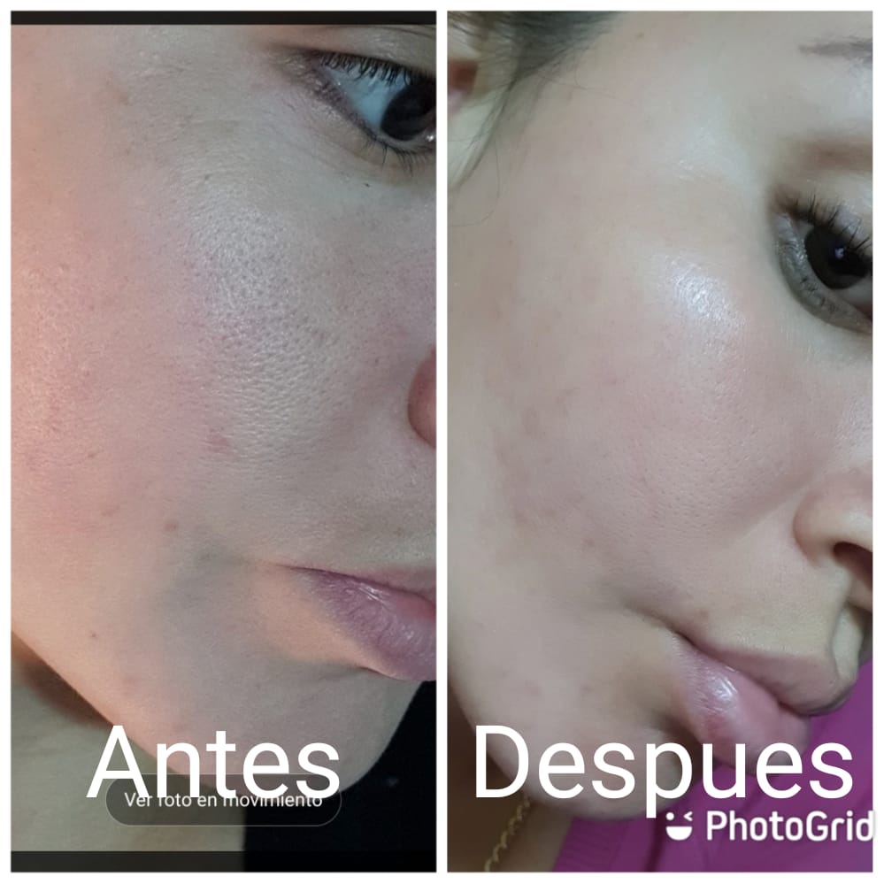 KIT COMPLETO EFECTO PORCELANA – PIEL LUMINOSA EN 2 SEMANAS