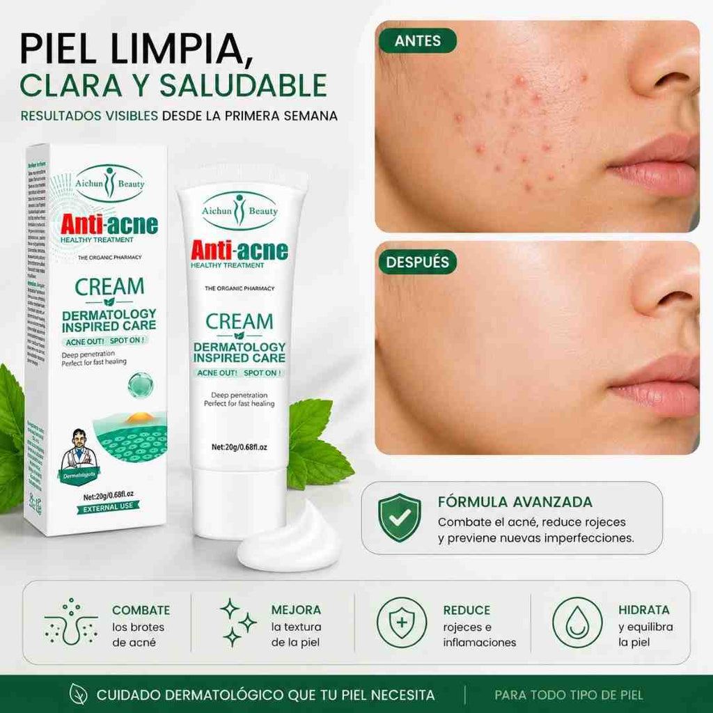 Aichun Beauty Antiacne 20G - Blondas Cosmeticos | Blondas Paraguay