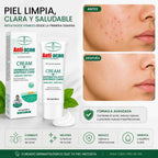 Aichun Beauty Antiacne 20G - Blondas Cosmeticos | Blondas Paraguay