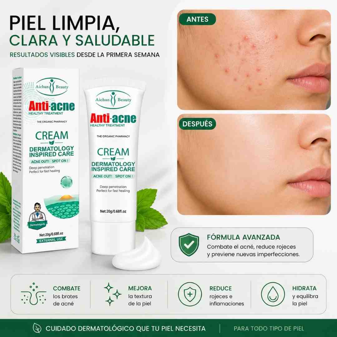 Aichun Beauty Antiacne 20G - Blondas Cosmeticos | Blondas Paraguay