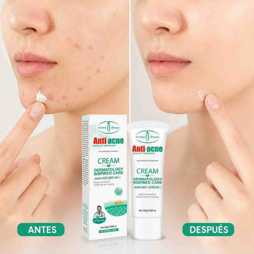 Aichun Beauty Antiacne 20G - Blondas Cosmeticos | Blondas Paraguay