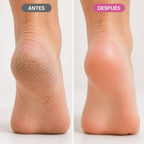Aichun Beauty Whitening Repair Foot Cream Fras 100 gr - Blondas Cosmeticos | Blondas Paraguay