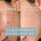 Bendita Tu Eres Efecto Porcelana Serum Dia 30 ml - Bendita tu eres | Blondas Paraguay
