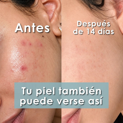 Bendita Tu Eres Efecto Porcelana Serum Dia 30 ml - Bendita tu eres | Blondas Paraguay
