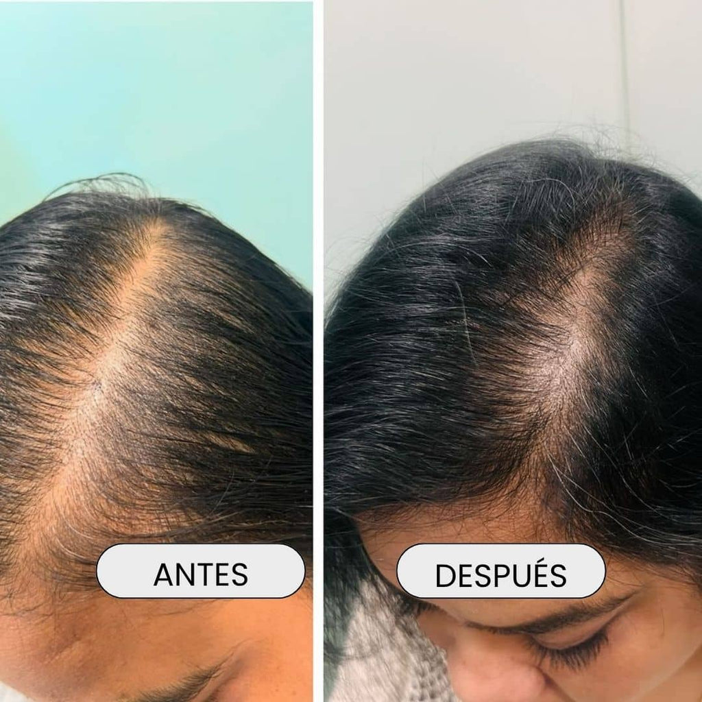 Bendita Tu Eres Kit Kit Tratamiento Anticaída Santo Ricino