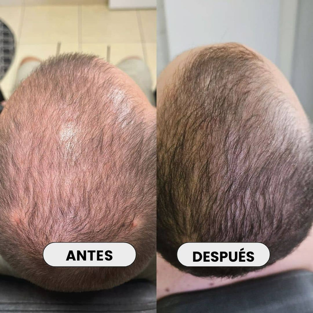 Bendita Tu Eres Kit Kit Tratamiento Anticaída Santo Ricino