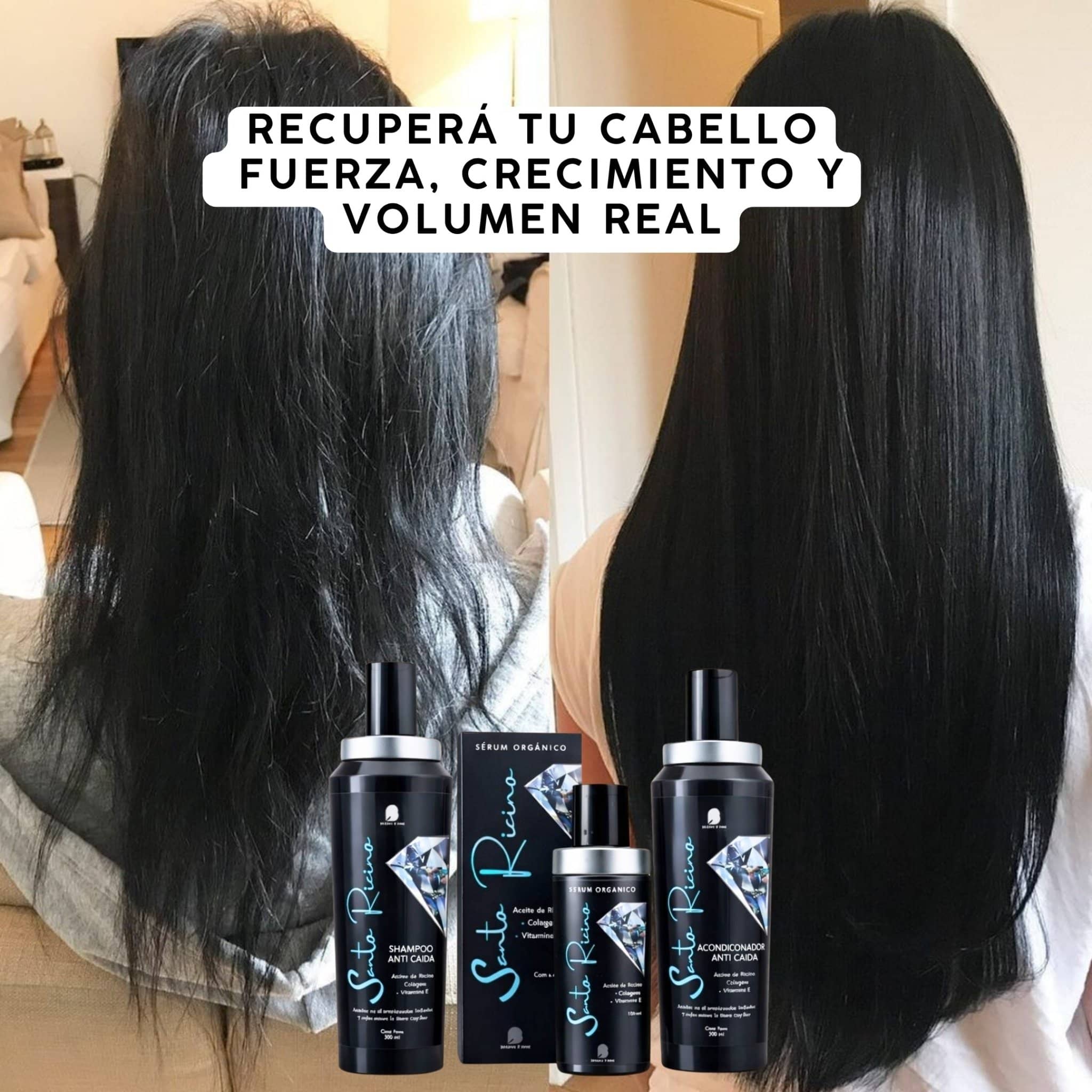 Bendita Tu Eres Kit Kit Tratamiento Anticaída Santo Ricino