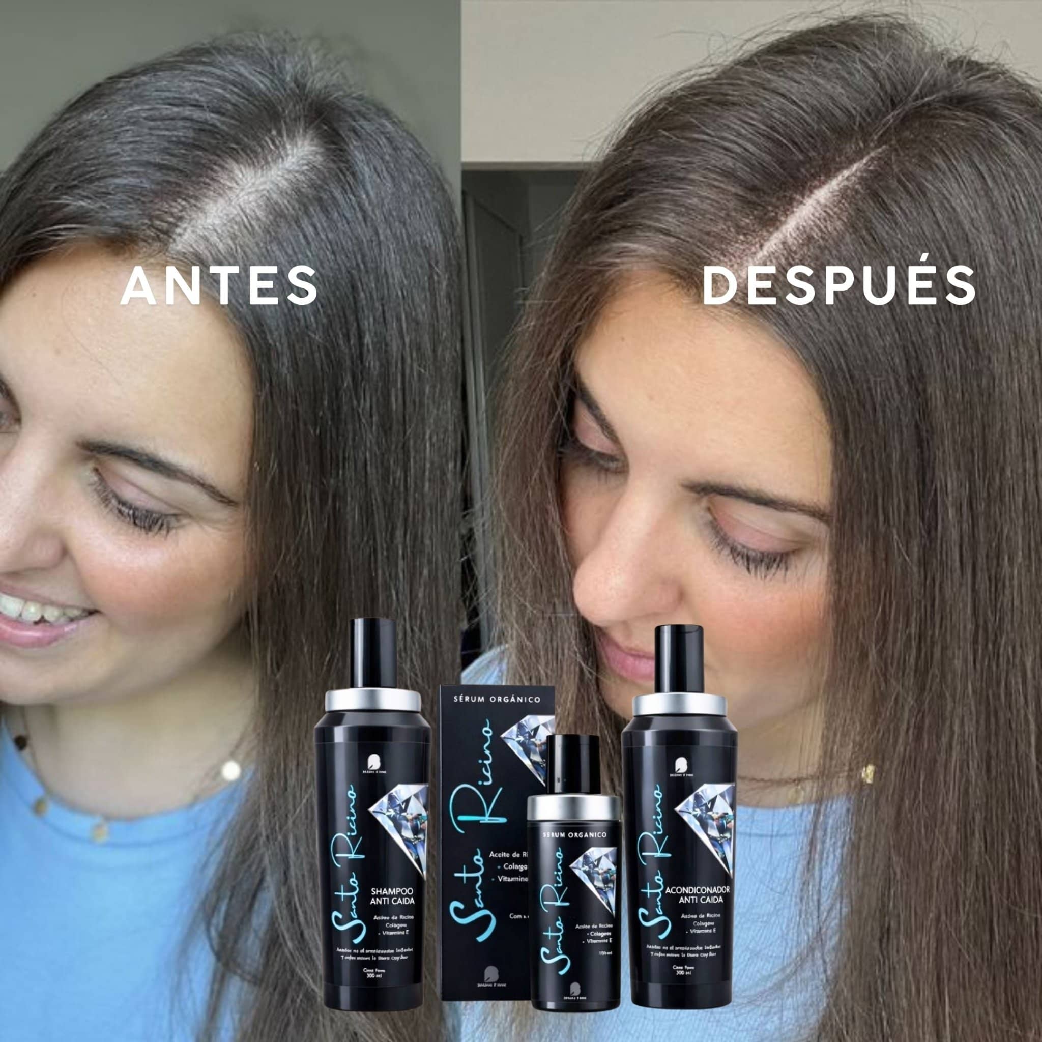 Bendita Tu Eres Kit Kit Tratamiento Anticaída Santo Ricino