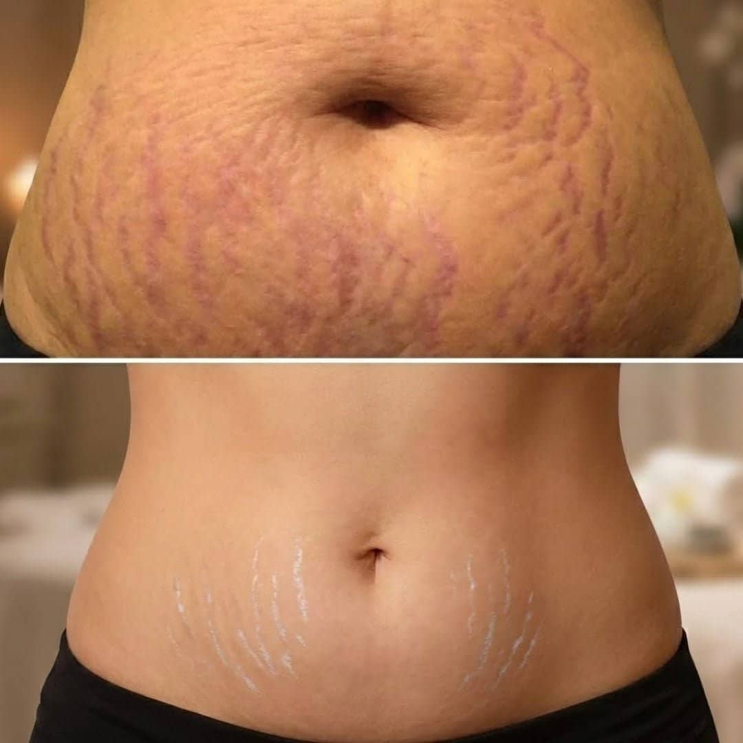 Bendita Tu Eres Tratamiento Capilar Bendita Tu Eres Serum Multifuncional  De Ricino   100 ml