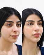 Bendita Tu Eres Tratamiento Facial Bendita Tu Eres Efecto Porcelana Contorno De Ojos 15 Ml