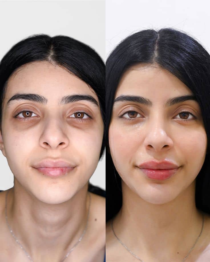 Bendita Tu Eres Tratamiento Facial Bendita Tu Eres Efecto Porcelana Contorno De Ojos 15 Ml
