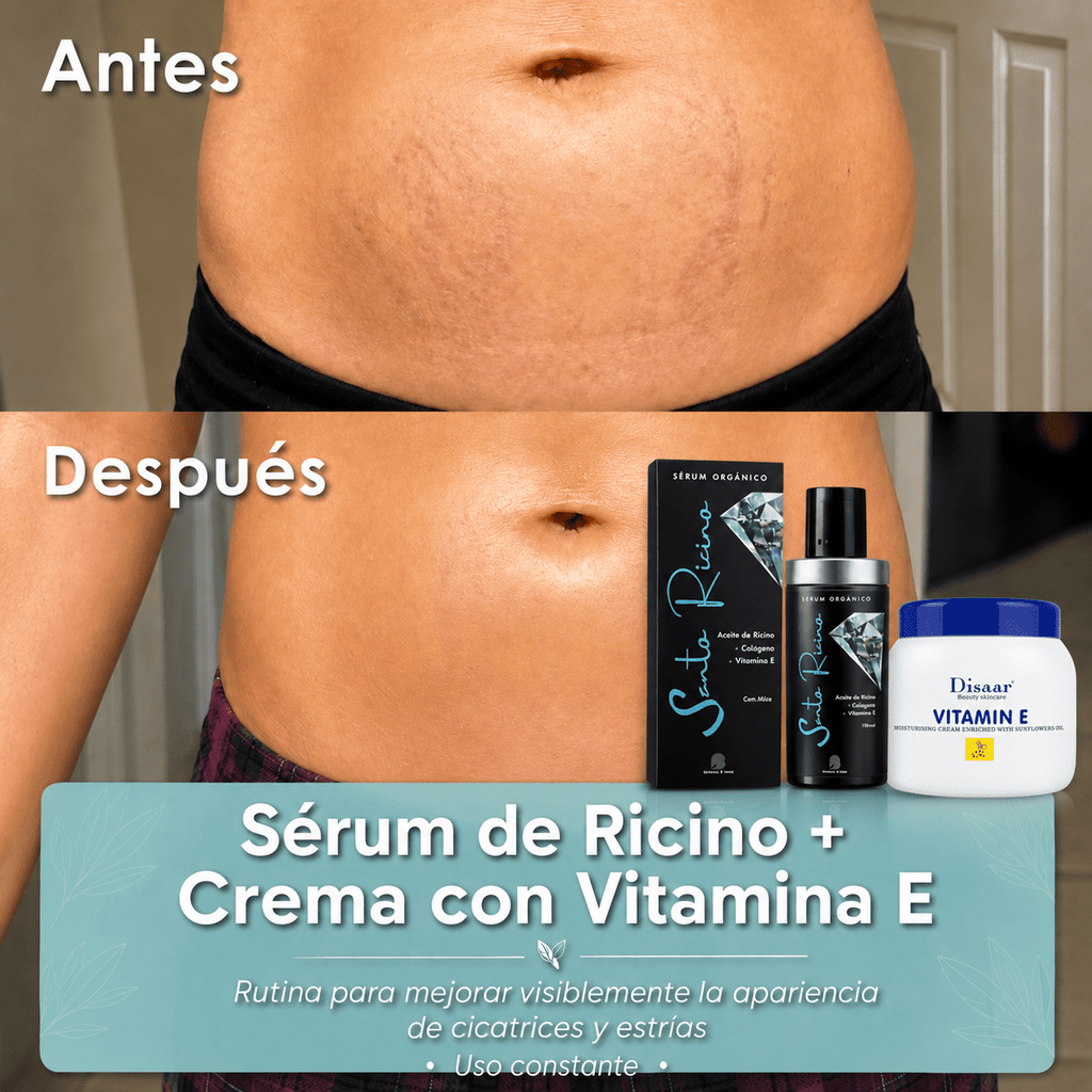 CHAU ESTRIAS - Sérum de Ricino + Crema con Vitamina E - Blondas Cosmeticos | Blondas Paraguay