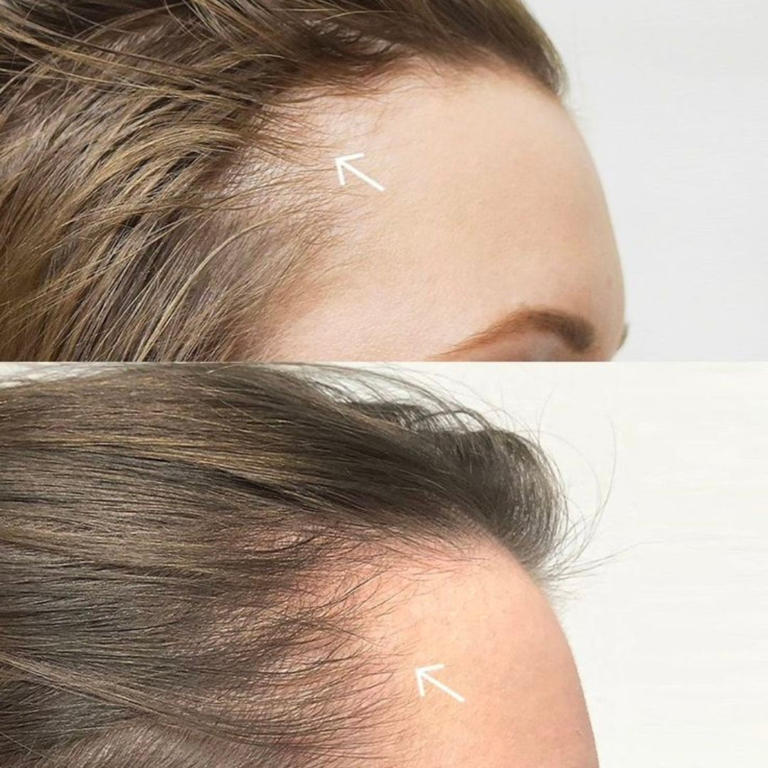 Glatten Tonico Control Caida 100 ml - Blondas Cosmeticos | Blondas Paraguay