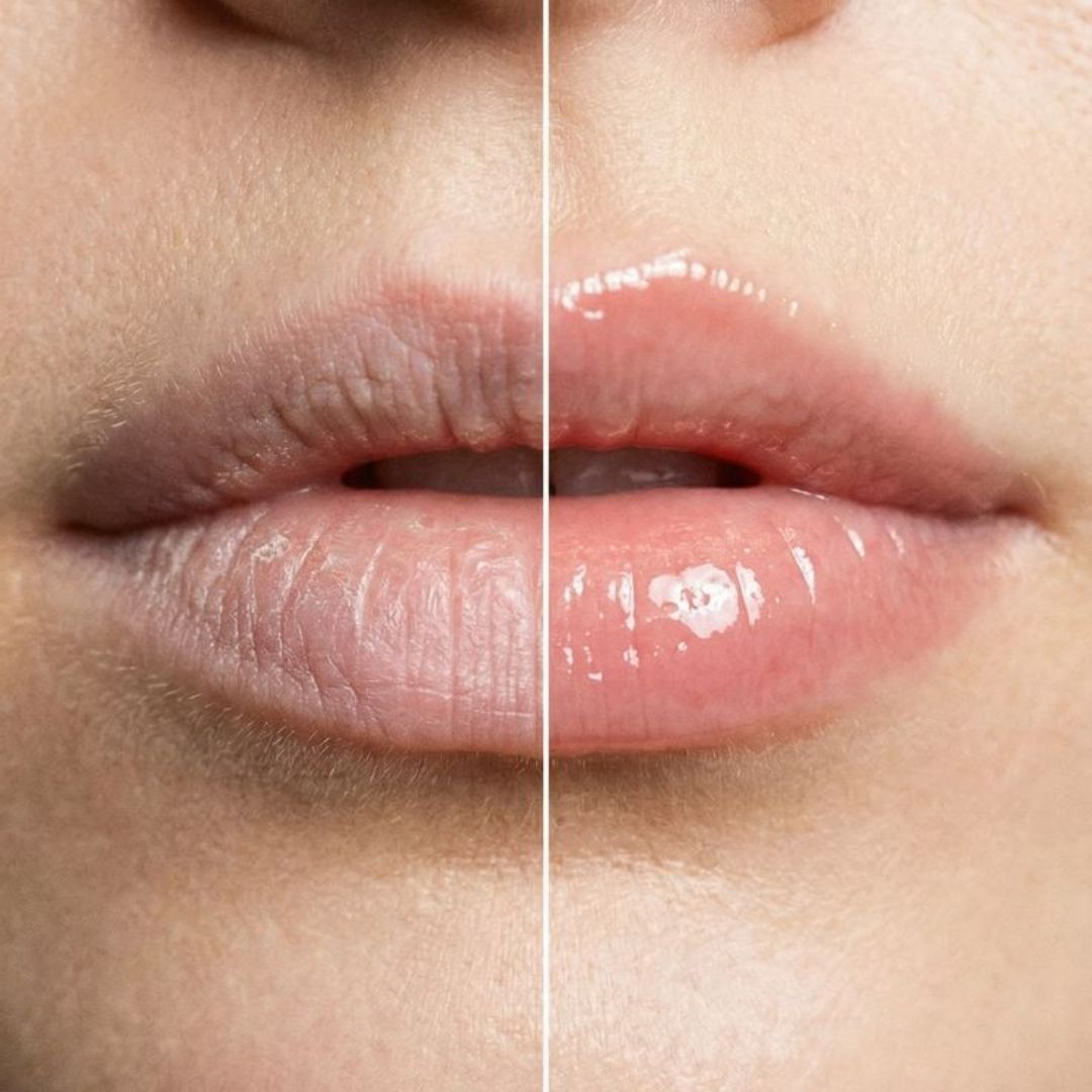 Kevin&Coco Lip Balm Varios 11 G - Blondas Cosmeticos | Blondas Paraguay