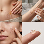 Pei Mei Tcm Scar And Acne Mark Fras 30 gr - Blondas Cosmeticos | Blondas Paraguay