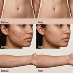 Pei Mei Tcm Scar And Acne Mark Fras 30 gr - Blondas Cosmeticos | Blondas Paraguay