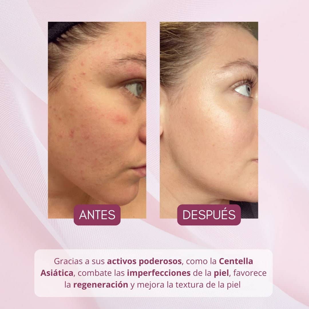 Bendita Tu Eres Kit Kit Facial Piel de Porcelana - Rutina Completa - Bendita tu eres