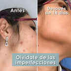 Bendita tu eres Kit Skincare Efecto Porcelana X 6