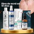 Serum Noche Efecto Porcelana Bendita Tu Eres + Tónico Facial Niacinamida Bendita Tu Eres + Crema Reparadora Anti Cicatrices + Limpiador Facial Bendita Tu Eres · 4 productos — Quema de San Juan - Blondas | Blondas Paraguay