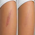 Wound Care And Antiscar Ointment Unid 1 Unid - Blondas Cosmeticos | Blondas Paraguay